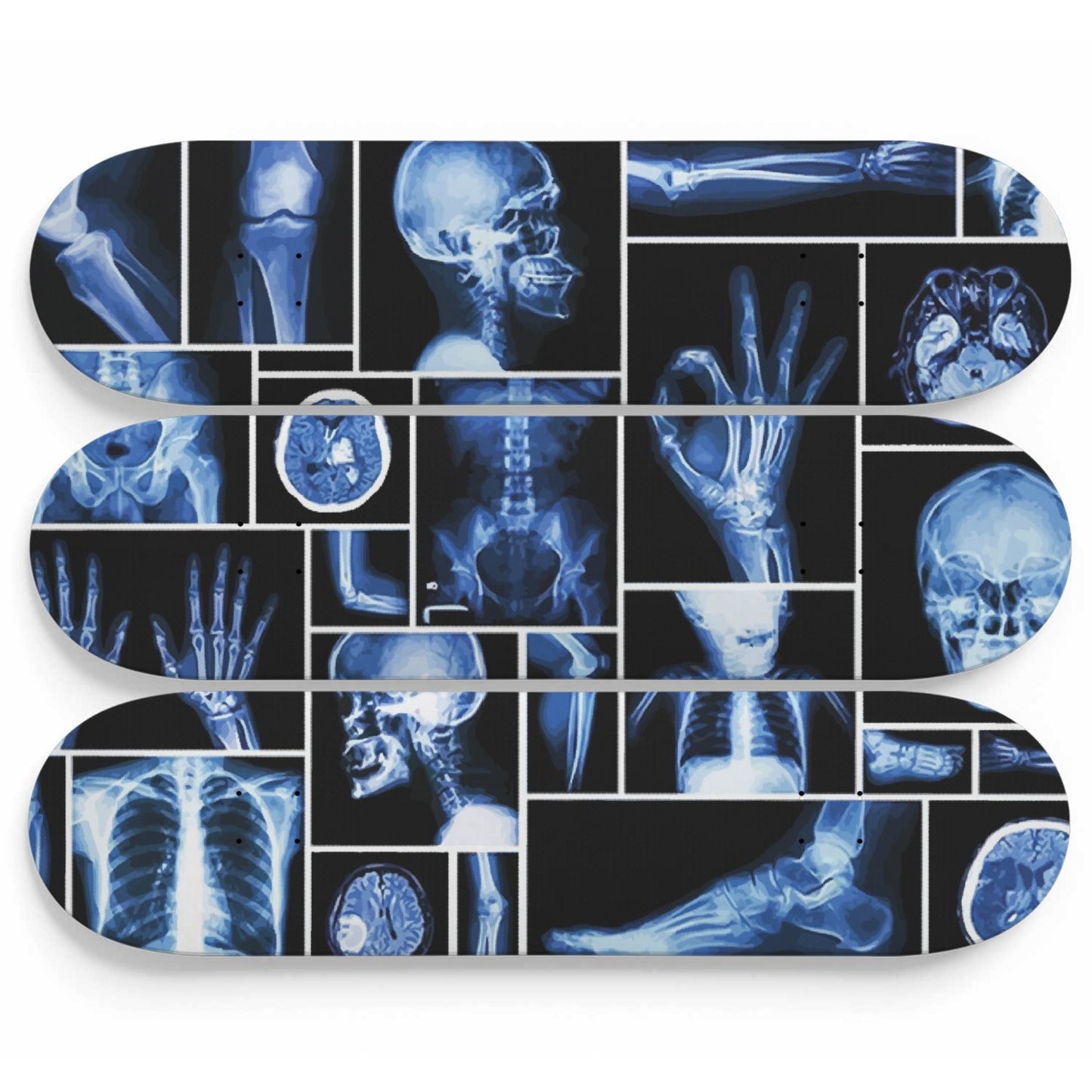 X-Ray Wallart | 3 Set of Skateboard Deck Wall Art, Hanged Room Decoration, Custom Unique Gift